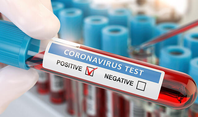 Coronaviruset provtagning