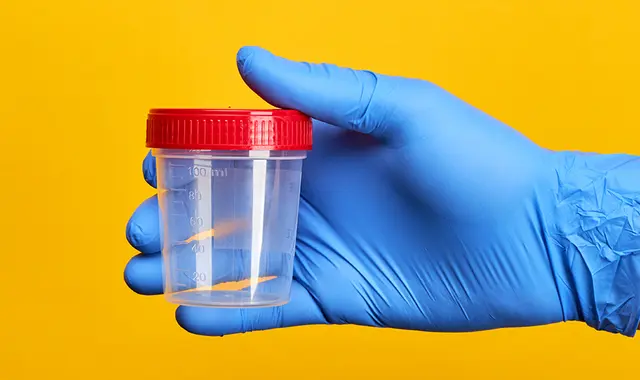Blå plasthandske håller i testkopp